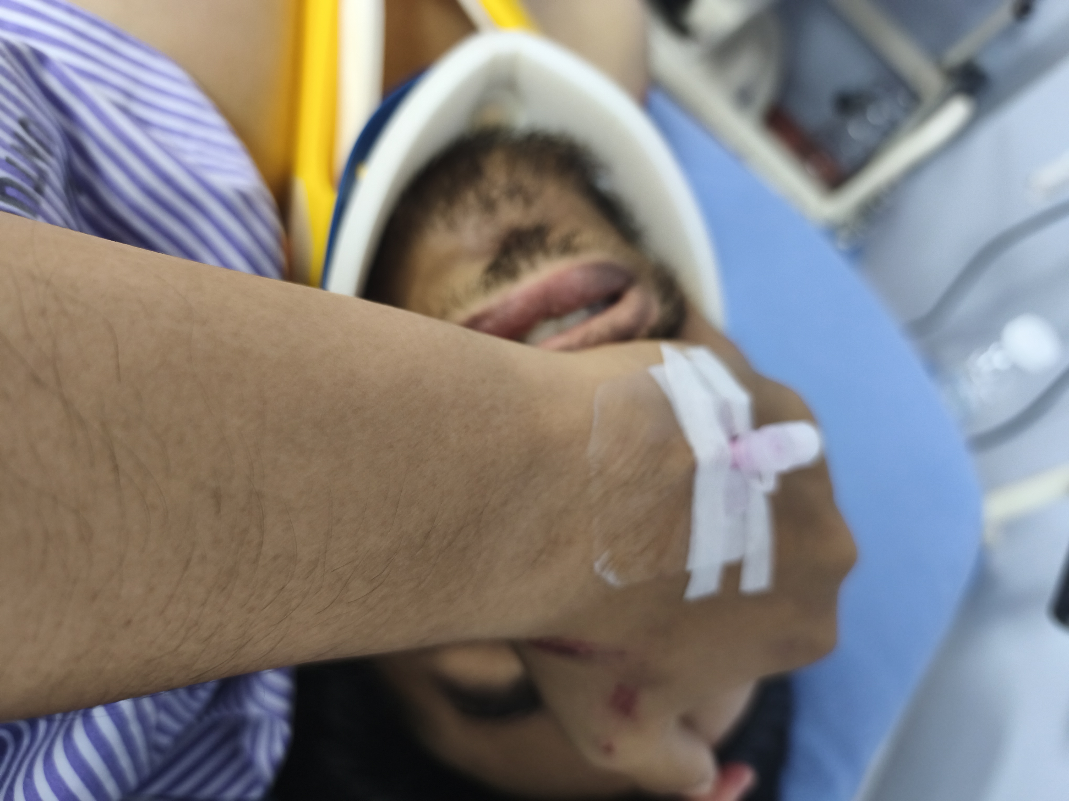 That damm neck brace